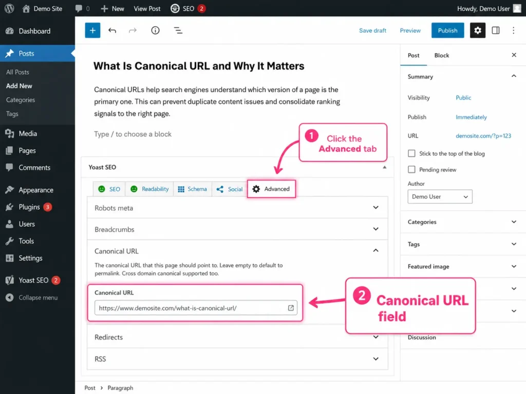 Yoast SEO canonical field screenshot